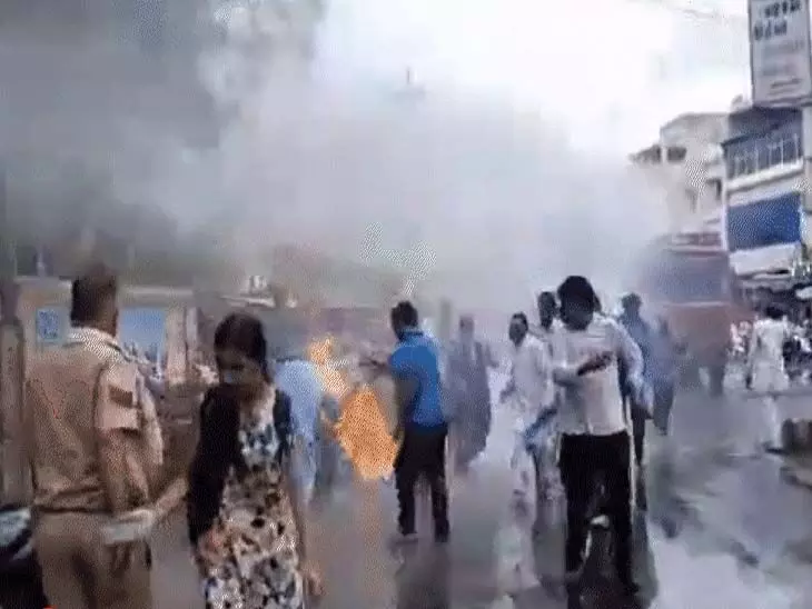 MP: विरोध प्रदर्शन में पुतला जलाते वक्त कांग्रेस नेता के कुर्ते में लगी आग