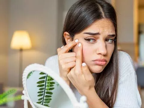 Home Remedies: चेहरे से मुँहासे हटाने के 5 टिप्स