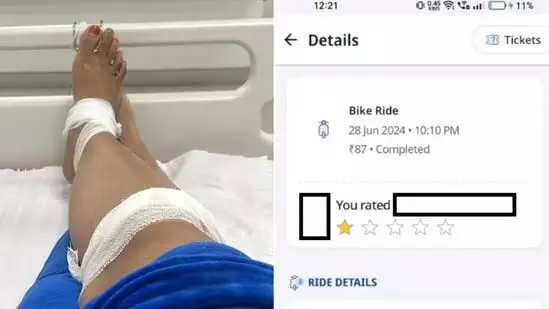 Rapido Bike चलाते समय, बाइक चालक की लापरवाही के कारण हुआ एक्सीडेंट