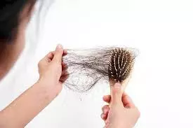 Hair Care Tips: मानसून में बाल झड़ रहे हैं आज से ही करें हेयर केयर