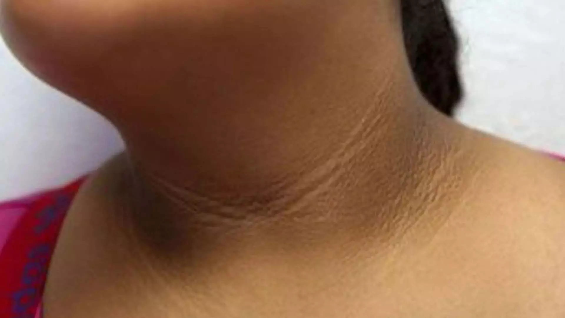 Beauty Tips: गर्दन के कालेपन को दूर करने के लिए करे ये चीज का उपयोग