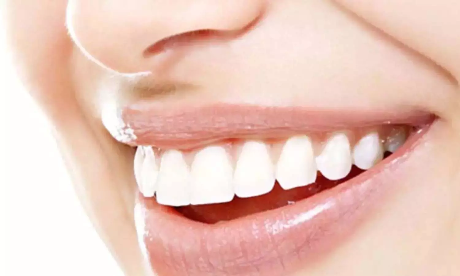 Beauty tips: दांतों को चमकाने के लिए दही में मिलाकर लगाएं ये चीज