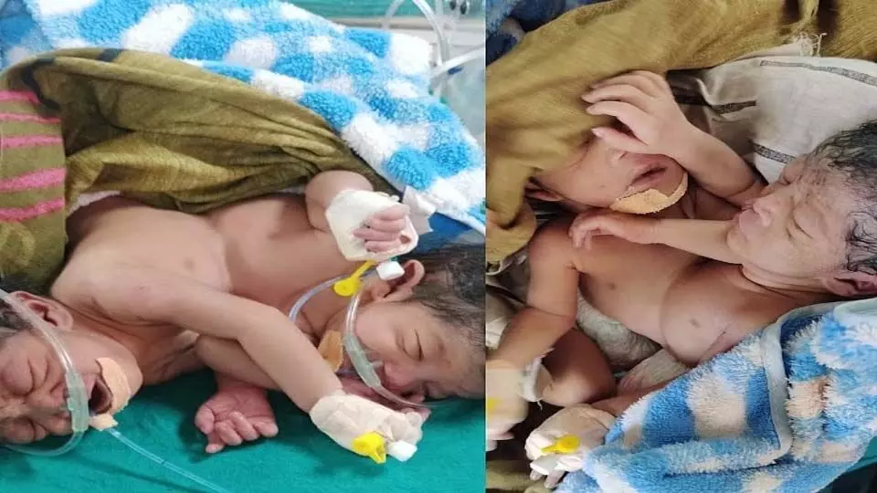 Ambala: छाती से जुड़े बच्चे ने माँ की गोद में ली आख​री सांस
