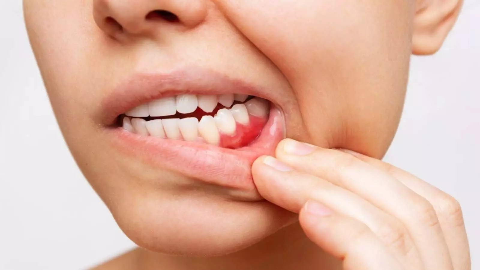Teeth Care: दांतों में परेशानी है तो भूलकर भी न खाये ये सब्जी