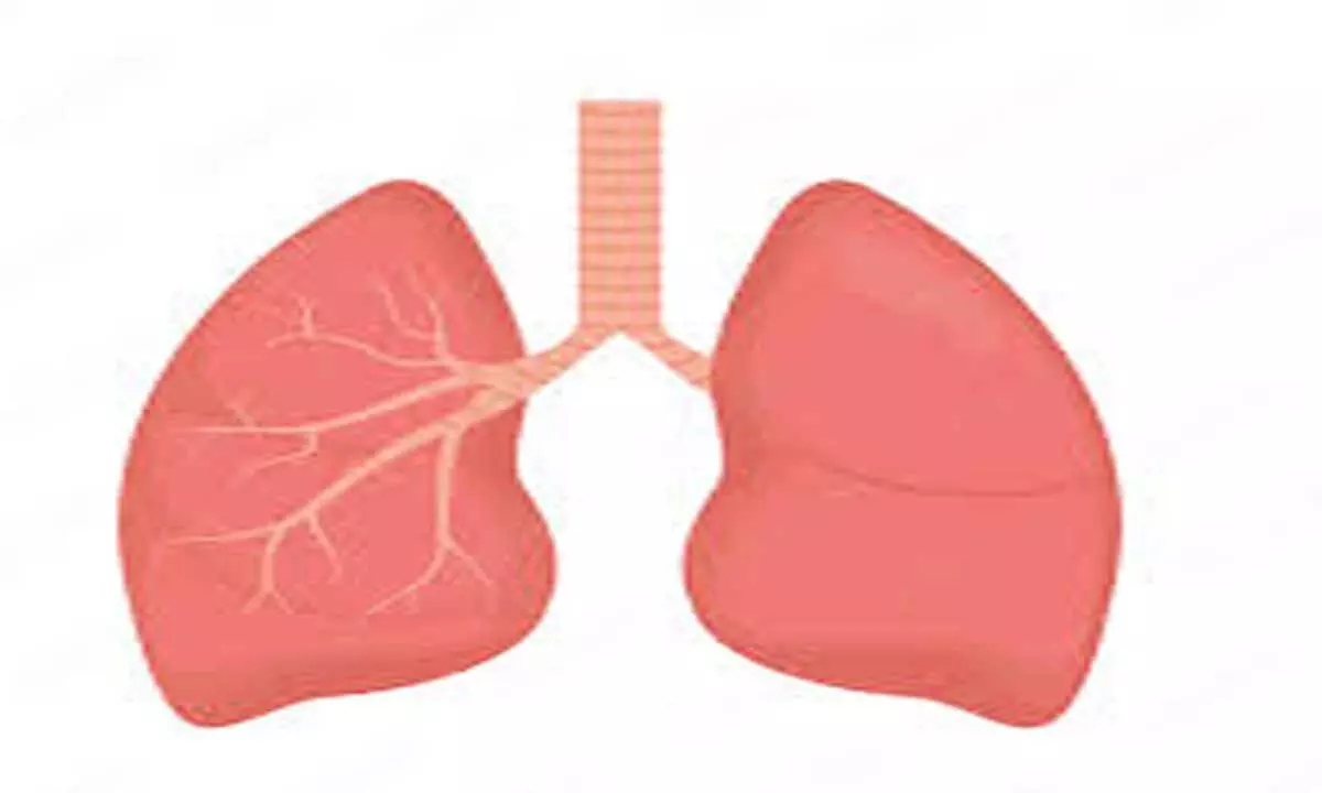Lungs: पल्मोनरी एम्बोलिज्म के 10 सबसे आम कारण