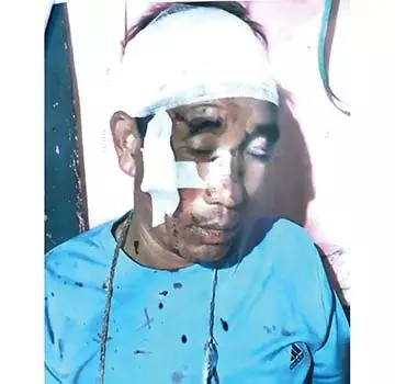 Arunachal : पुलिस थाने में मारपीट का आरोप लगाते हुए व्यक्ति ने एपीएसएचआरसी में शिकायत दर्ज कराई