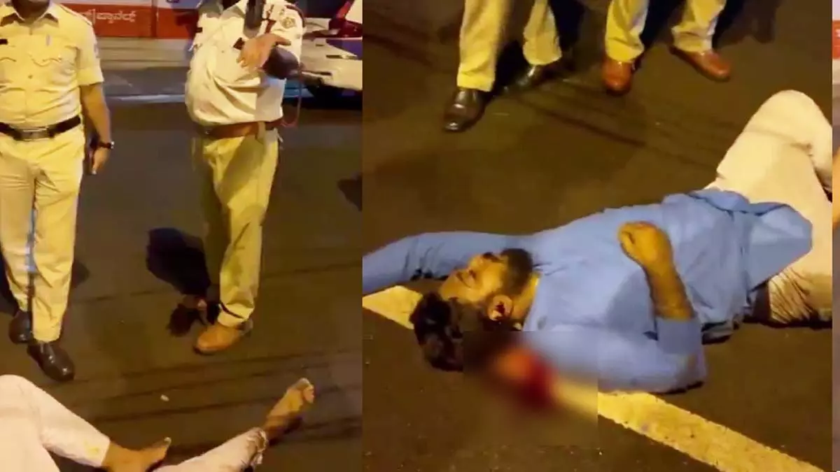 Bengaluru: सड़क पर घायल पड़ा रहा युवक, बहस करते रहे पुलिसकर्मी
