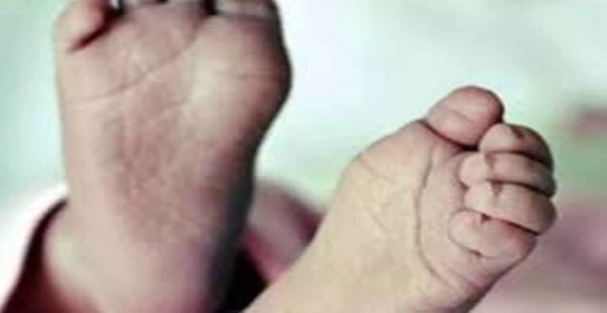 UP में महिला ने दिया 2 चेहरे, 4 पैर और 4 हाथ वाले बच्चे को जन्म