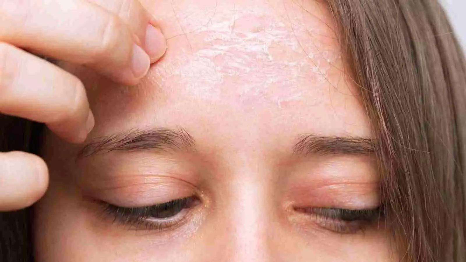 Skin में विभिन्न तरीकों से खुजली और चोट पहुंच सकते