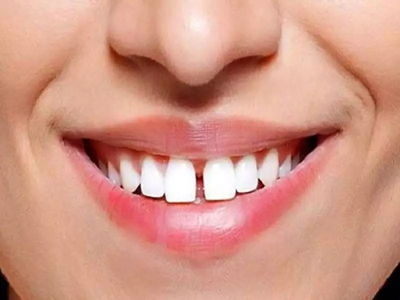 Samudrik Shastra: जानें दांतों के बीच गैप होना कितना हैं फायदे