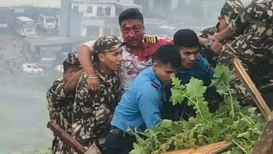 BIG BREAKING: नेपाल प्लेन हादसे के बाद पायलट की सामने आई तस्वीर