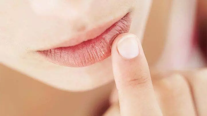 Lips Care: फटे होठों  के लिए बेस्ट है नारियल से बना लिप बाम