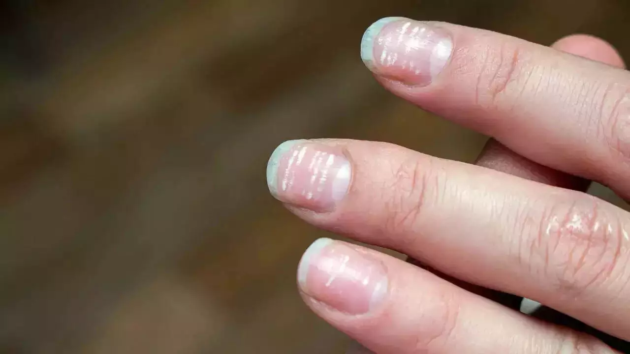 Nails Care: क्या आपका भी नेल्स बार बार टूटता है तो अपनाये ये टिप्स