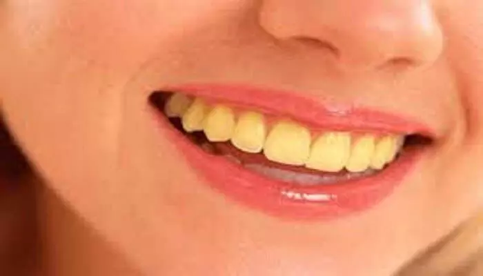 Teeth Tips: दांतों का पीलापन दूर करता है ये लाभदायक फल