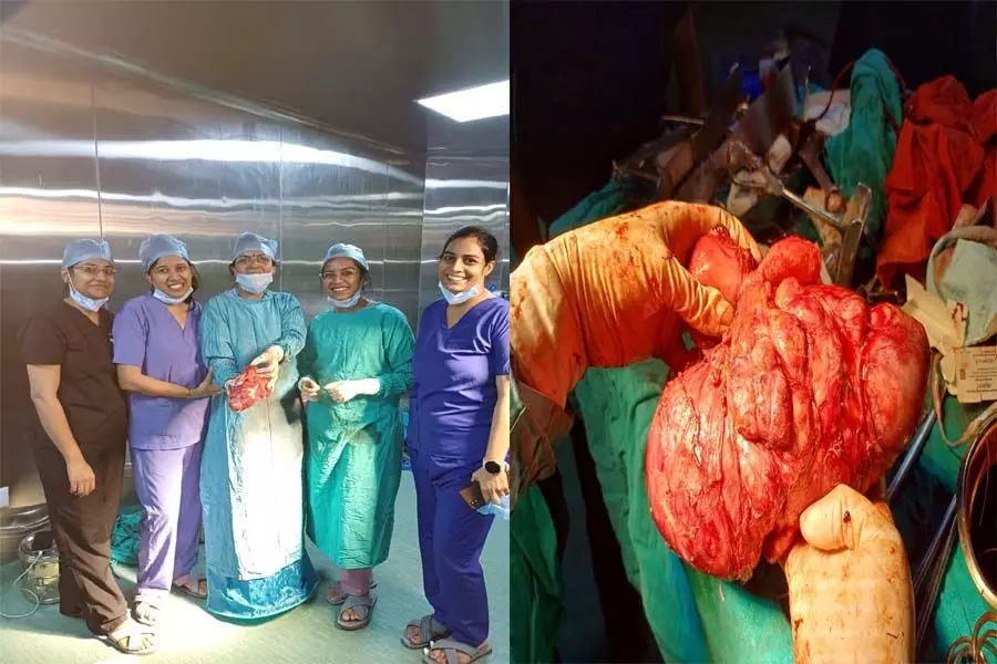 Hospital में 3 घंटे चली सर्जरी, मरीज के पेट से निकाला 23 सेमी लंबा और 1.5 किलो का ट्यूमर