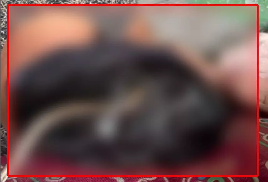 OMG! सोती हुई महिला के वहां घुसा सांप, देखें वायरल VIDEO...