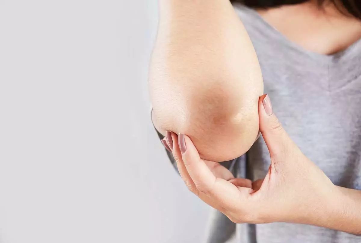 Skin Care: कोहनी या घुटने का कालापन चुटकियों में होगा दूर, जाने कैसे