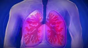 World Lung Cancer Day फेफड़ों के कैंसर के शुरुआती लक्षणों के बारे में जाने