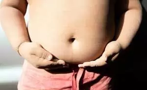 युवावस्था में खराब स्वास्थ्य का कारण बन सकता है बचपन का मोटापा: विशेषज्ञ