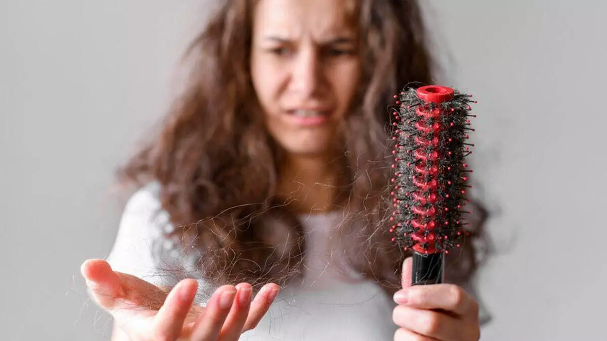 Life Style : क्या आप भी बालों के झड़ने और टूटने से परेशान