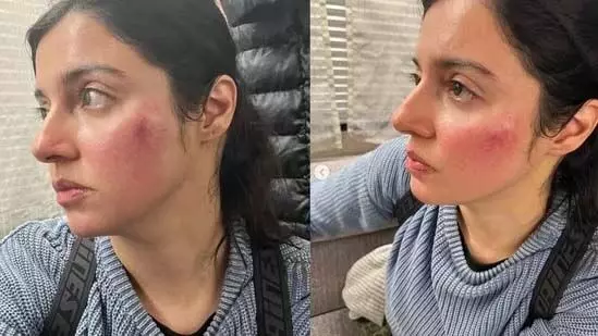 सावी की शूटिंग के दौरान वह बुरी तरह घायल हो गई थीं: Divya Khosla