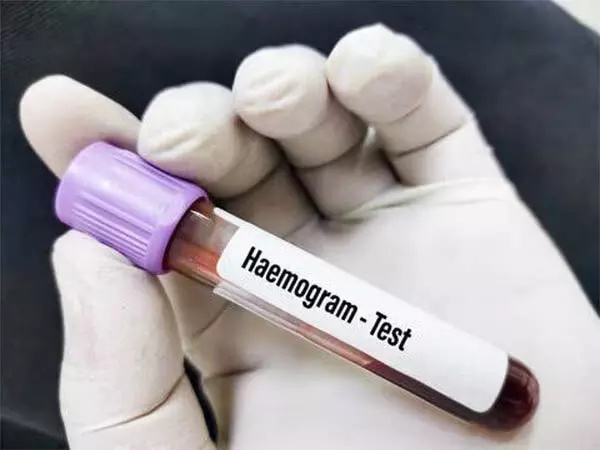 blood परीक्षण ( हेमोग्राम )कब करवाना चाहिए?