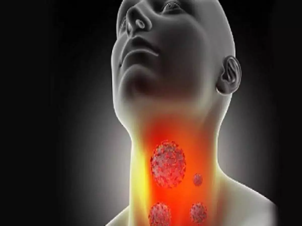 Thyroid cancer का जानें लक्षण और इलाज