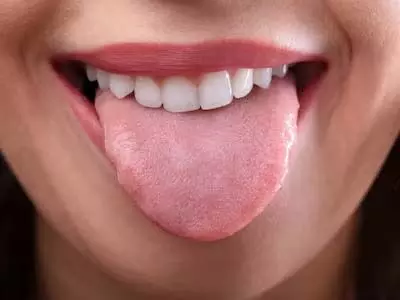 Tongue से भी निकलता हैं खून तो न करे इग्नोर करे ये काम