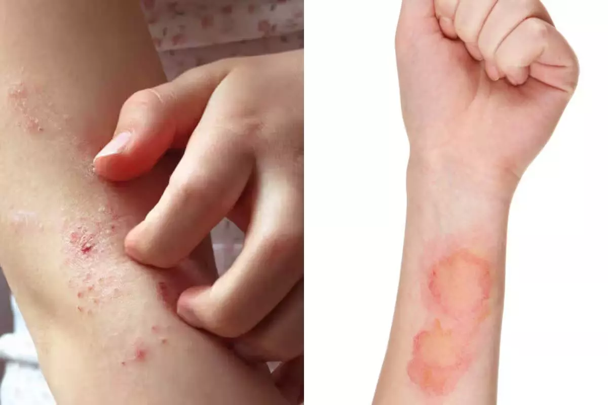 Diseases ने हाल ही में संयुक्त राज्य अमेरिका में तबाही मचाई