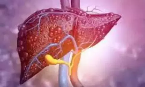 Diabetes और मोटापे से लीवर कैंसर के दोबारा होने का खतरा बढ़ जाता है- अध्ययन