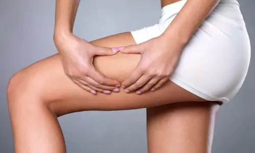 Lifestyle: अपने जांघों पर लटकी चर्बी को लेकर है चिंतित, अब आसानी से घटेगा बजन