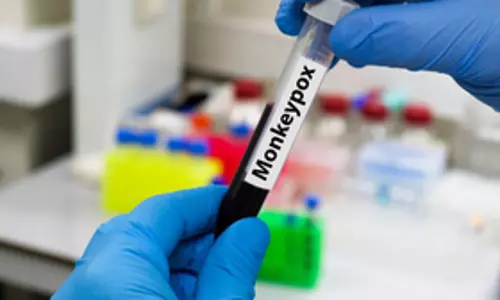 युगांडा में एमपॉक्स के मामले बढ़कर 41 हुए: Health official