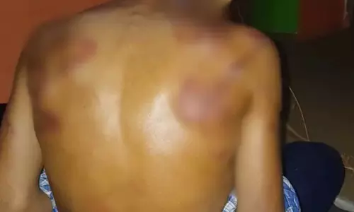 J&K: स्कूल में छात्र की बेरहमी से पिटाई, शिक्षक निलंबित