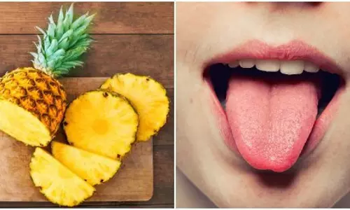 Lifestyle: अनानास खाने से गले में होती हैं खराश, जान लें इसे खाने का सही तरीका Lifestyle: अनानास खाने से गले में होती हैं खराश, जान लें इसे खाने का सही तरीका