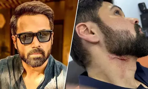 Hyderabad में गुडाचारी 2 के सेट पर इमरान हाशमी को लगी चोट, फोटो वायरल
