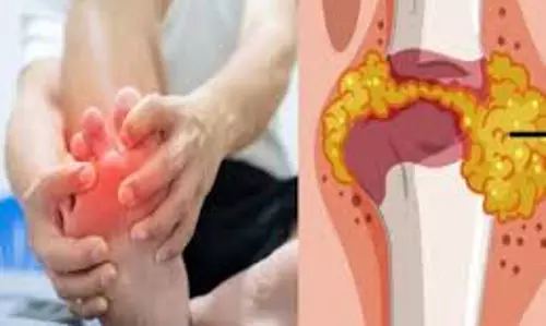 Lifestyle: यूरिक एसिड की समस्या से है परेशान, अपनाये ये तरीका