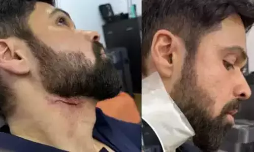 Imran हैदराबाद में शूटिंग के वक्त घायल हुए