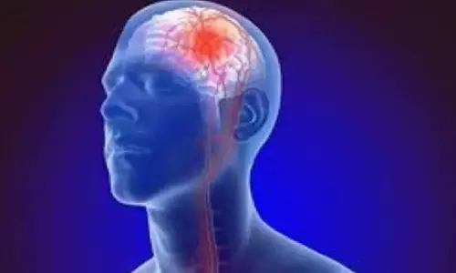 Silent Stroke आपके मस्तिष्क के स्वास्थ्य को पहुंचा सकता है नुकसान Silent Stroke आपके मस्तिष्क के स्वास्थ्य को पहुंचा सकता है नुकसान