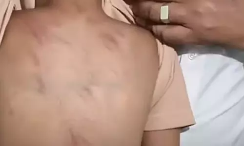 मट्टनचेरी: साढ़े तीन साल के बच्चे की बेरहमी से पिटाई, Teacher गिरफ्तार