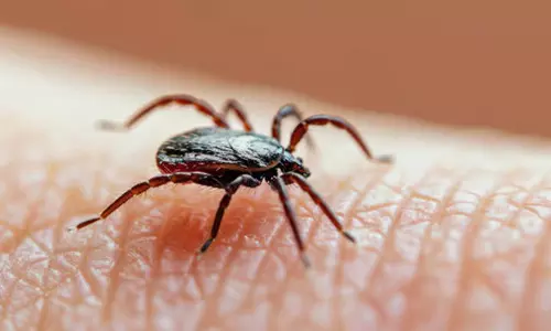 तिरुवनंतपुरम में Murine Typhus: पिस्सू बुखार जैसी एक दुर्लभ बीमारी
