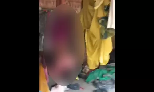 बाप रे! हैवान पिता ने बेटी की बेरहमी से पिटाई की, उल्टा लटकाया
