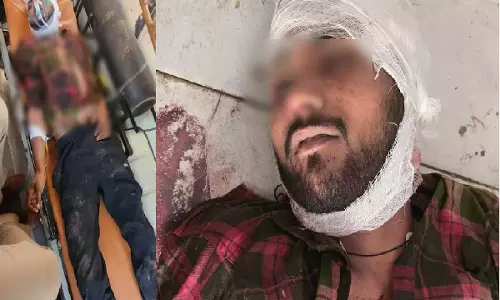 एनकाउंटर: थाना प्रभारी-सिपाही को गोली लगी, डेढ़ लाख का इनामी बदमाश ढेर एनकाउंटर: थाना प्रभारी-सिपाही को गोली लगी, डेढ़ लाख का इनामी बदमाश ढेर