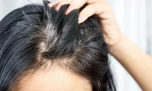 सफ़ेद बालों के कारण चेहरे की खूबसूरती कम हो जाती