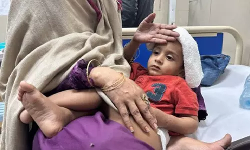 Pakistan: कराची में डिप्थीरिया से 100 से अधिक बच्चों की मौत