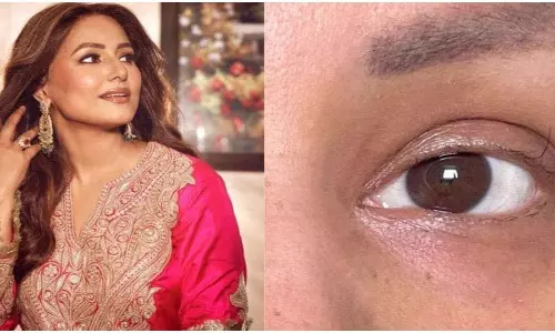 Hina Khan ने शेयर की अपनी ‘सिंगल आईलैश’ की तस्वीर Hina Khan ने शेयर की अपनी ‘सिंगल आईलैश’ की तस्वीर