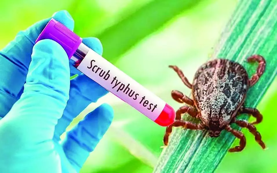 Scrub Typhus: IGMC में स्क्रब टायफस से दो मौतें