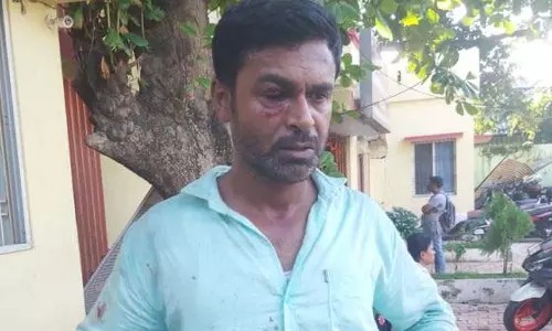 अवैध शराब कारोबारियों के हमले में आबकारी कांस्टेबल घायल अवैध शराब कारोबारियों के हमले में आबकारी कांस्टेबल घायल