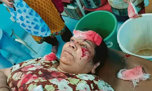 Chamba में आवारा कुत्तों द्वारा एक दर्जन से अधिक लोगों को काटने से दहशत का माहौल Chamba में आवारा कुत्तों द्वारा एक दर्जन से अधिक लोगों को काटने से दहशत का माहौल
