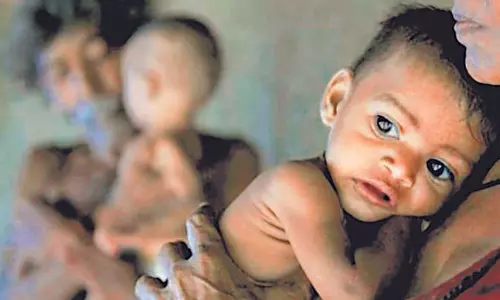 Haryana :  सर्वेक्षण गुरुग्राम के बच्चों में कुपोषण और जन्म के समय कम वजन आम बात