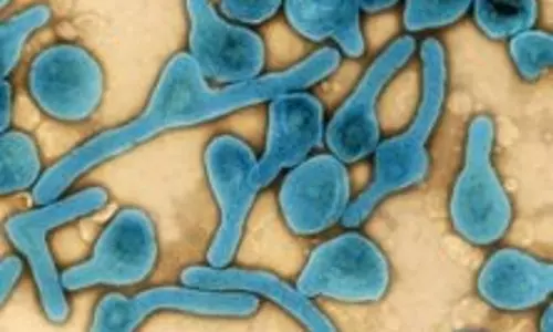 Rwanda ने मारबर्ग प्रतिक्रिया में आशाजनक प्रगति देखी, क्योंकि रिकवरी दर में सुधार हुआ है Rwanda ने मारबर्ग प्रतिक्रिया में आशाजनक प्रगति देखी, क्योंकि रिकवरी दर में सुधार हुआ है